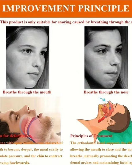 Anti-Snoring Band for Open Mouth Breathing 