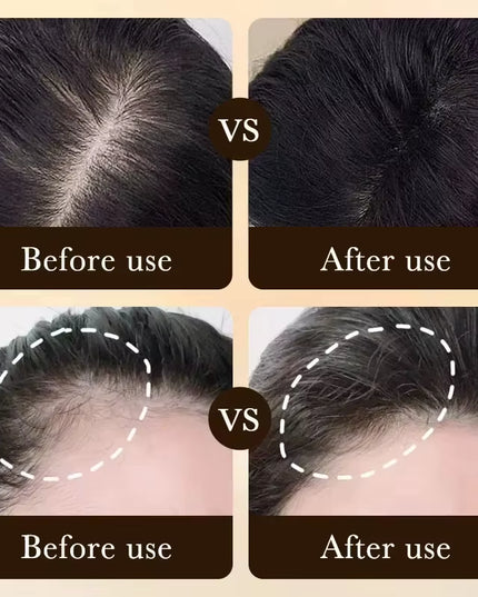 Anti-Hair loss & Regrowth Treatment oil , Non Greasy Improve Scalp Circulation and Strengthens Hair & Nourishes Scalp