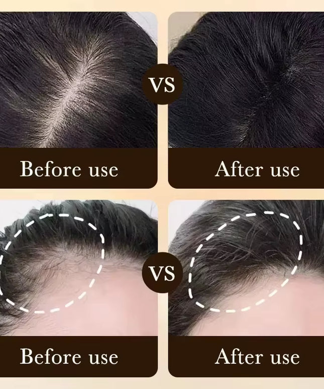 Anti-Hair loss & Regrowth Treatment oil , Non Greasy Improve Scalp Circulation and Strengthens Hair & Nourishes Scalp