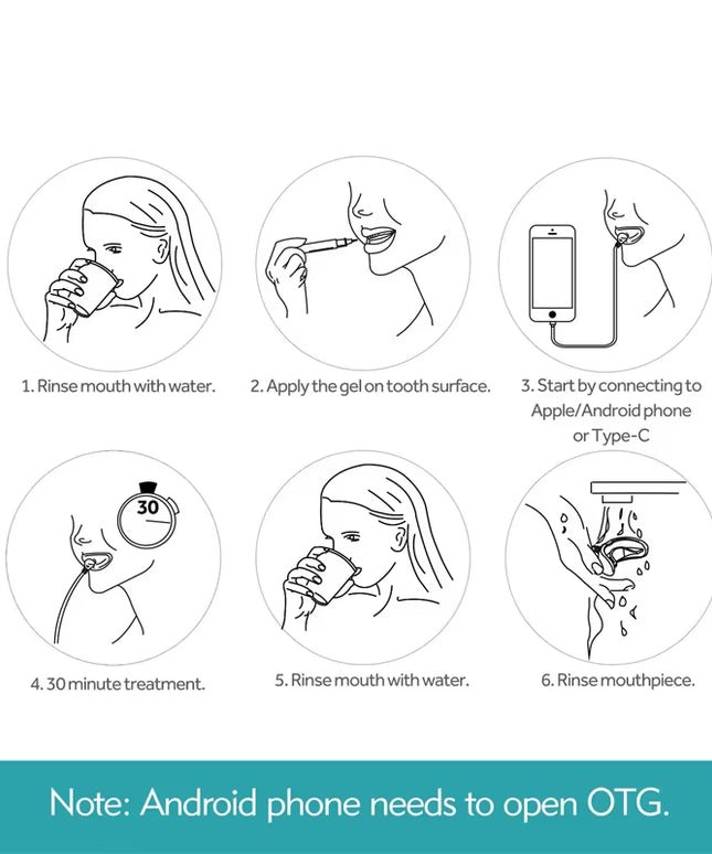 BrightTeeth - portable LED blue light Teeth Whitening device chargable by Usb/Iphone/Android 