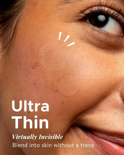 360Pcs  Invisible and Anti-Inflammatory Healing Absorbing  Face Acne, pimple Patch for Skin Care 