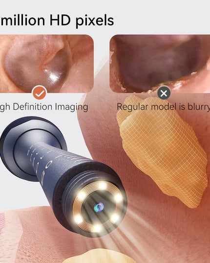 Smart Ear Cleaner- Waterproof Ear Wax Removal kit with Camera for any age or pets