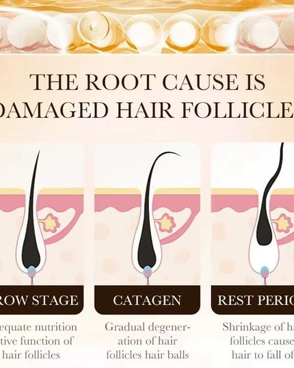 Anti-Hair loss & Regrowth Treatment oil , Non Greasy Improve Scalp Circulation and Strengthens Hair & Nourishes Scalp